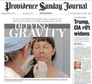 A newspaper article about gravity and facial surgery.