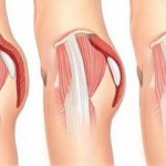 A series of three pictures showing the muscles and ligaments of the knee.