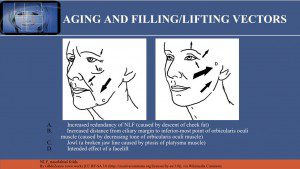 A poster showing how to use the face for facial lifting.