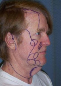A man with purple lines drawn on his face.