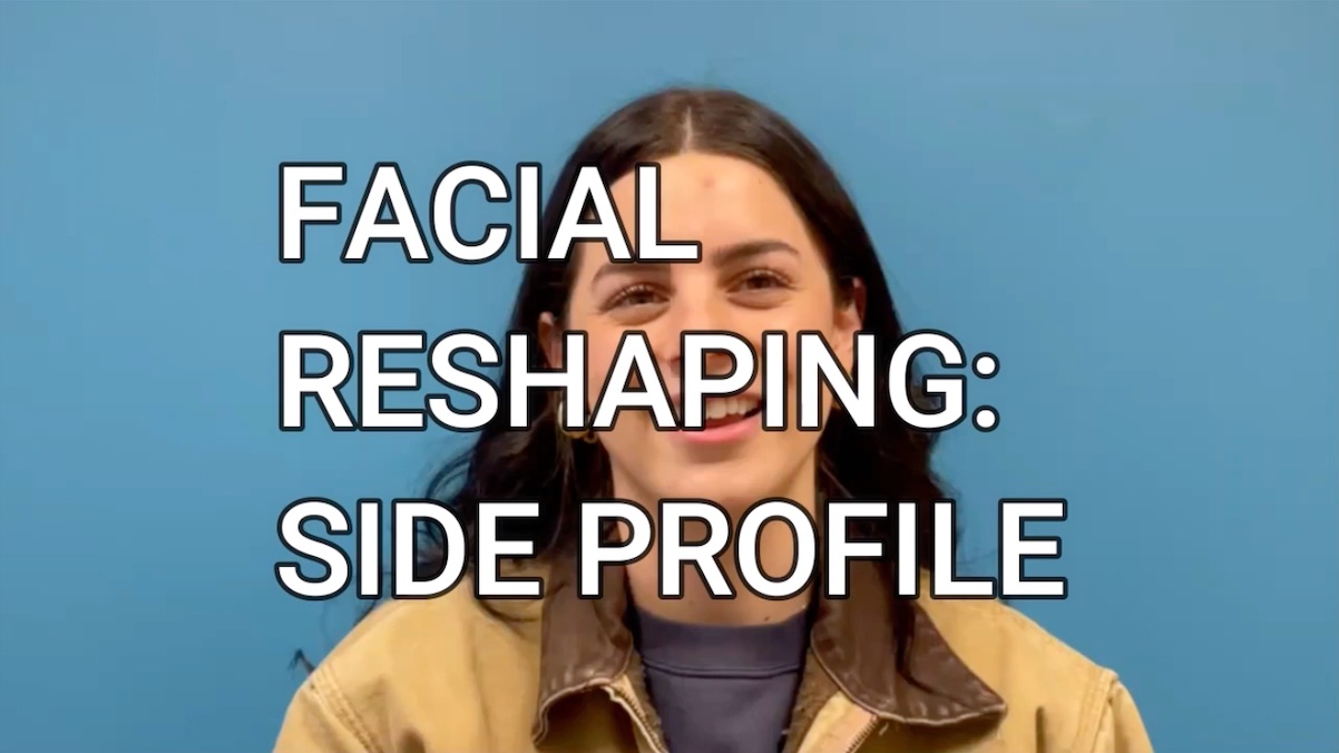 Facial Contouring Part 5 | Patient Perspective